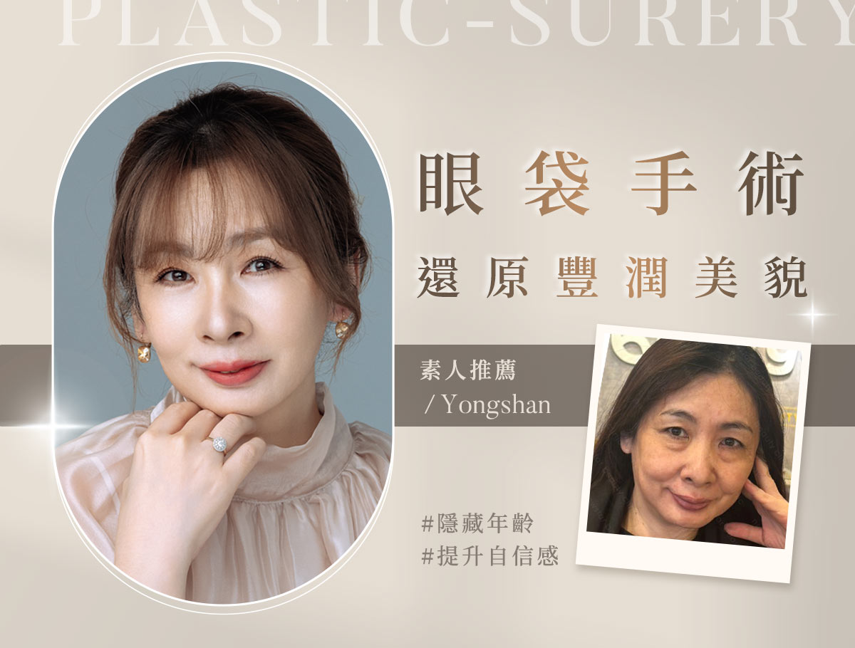 手術官網案例_外bn_阿姨