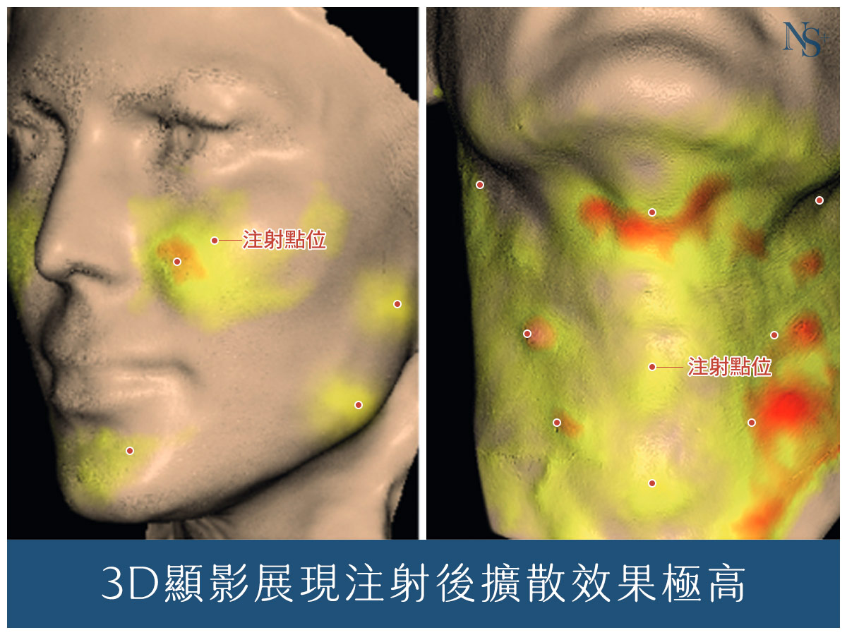 逆時針優勢_擴散性高