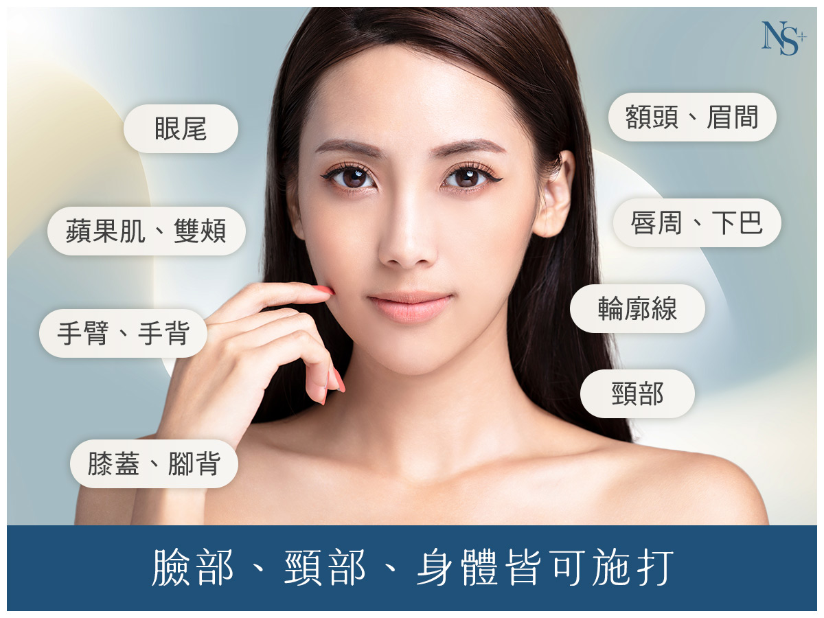 逆時針優勢_施打部位多