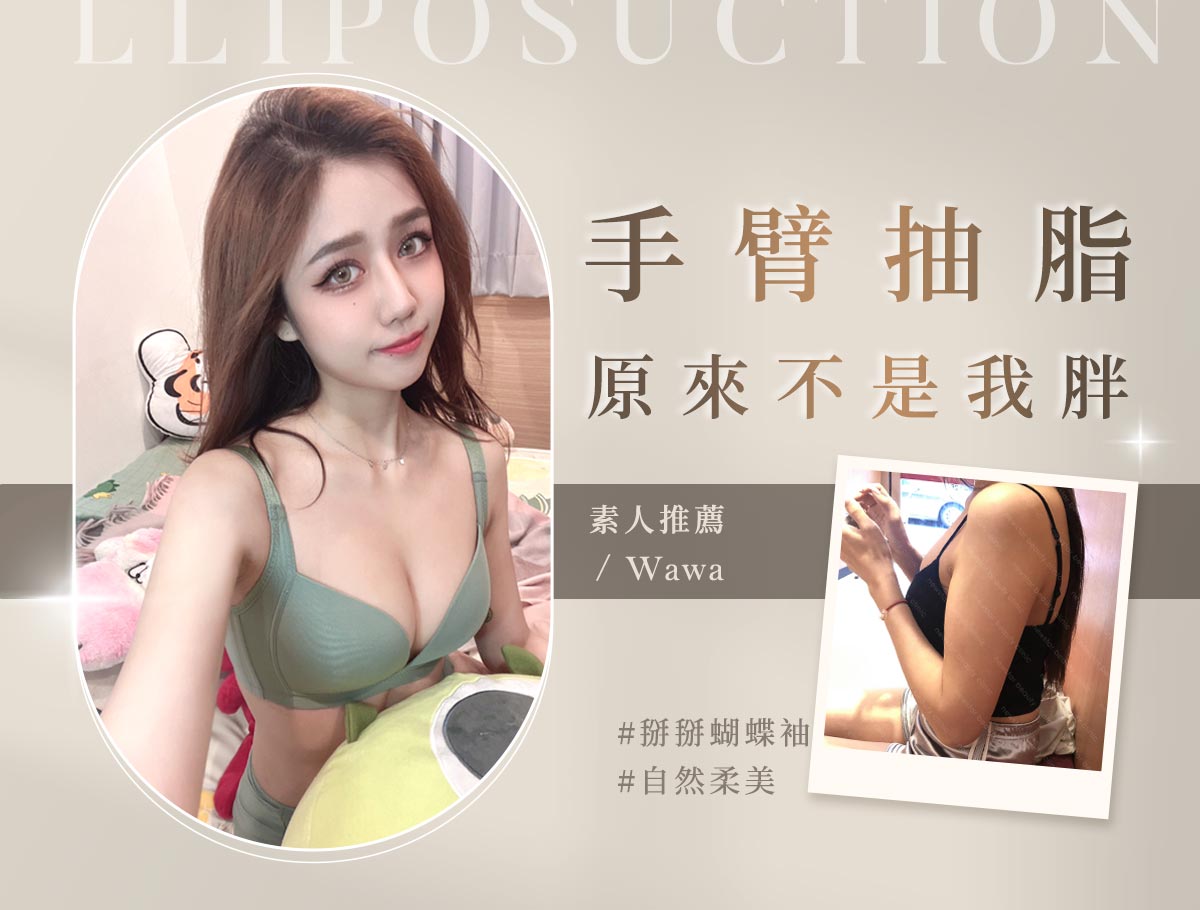 手術官網案例_外bn_娃娃01