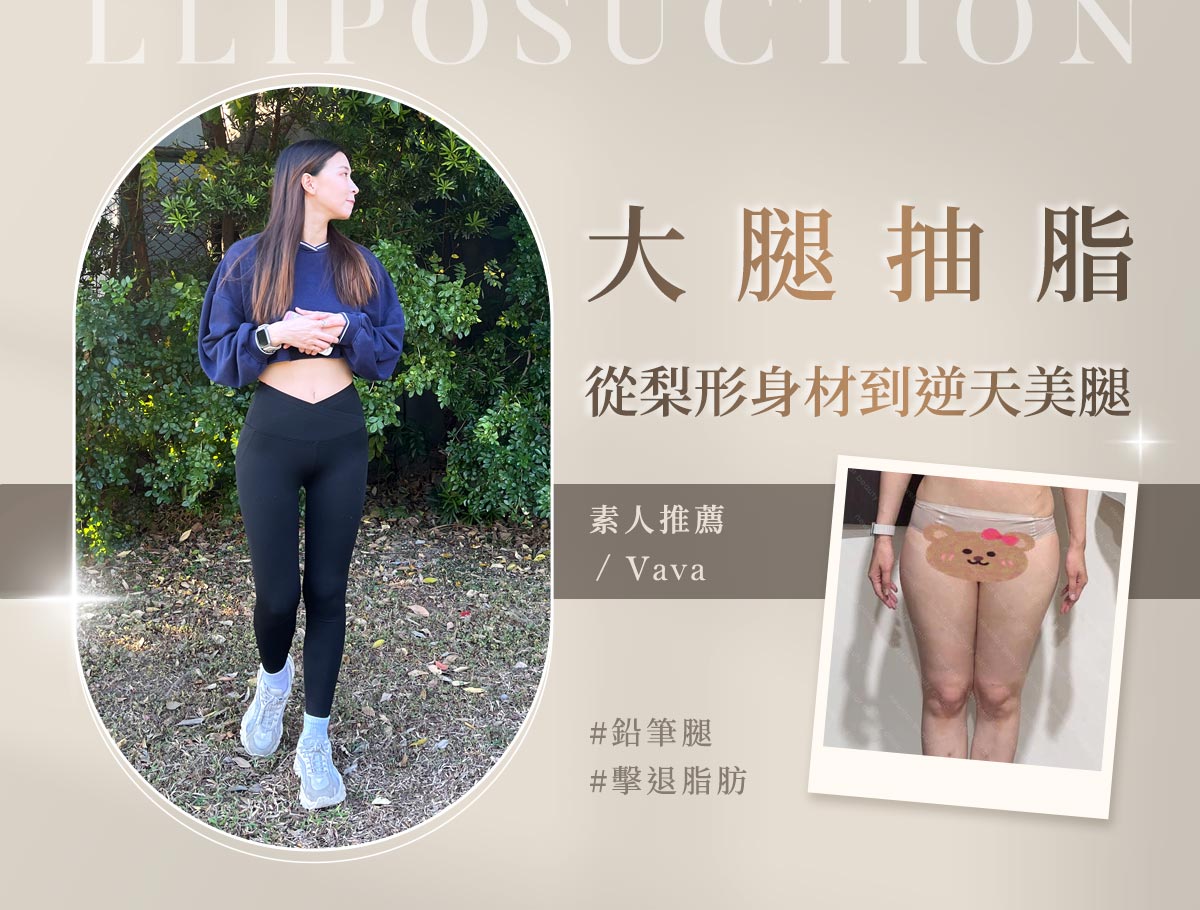 手術官網案例_外bn_vava