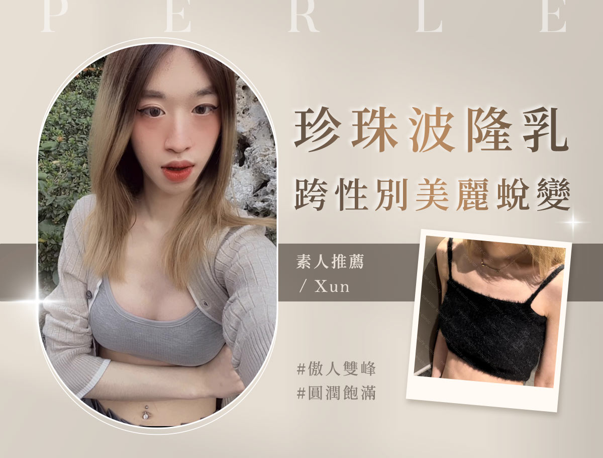 手術官網案例_外bn_珍珠波隆乳手術