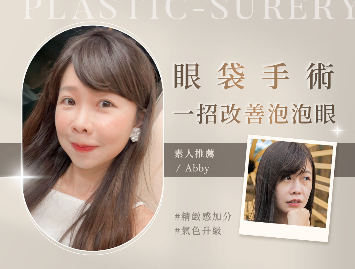 手術官網案例_外bn_美惠_眼袋