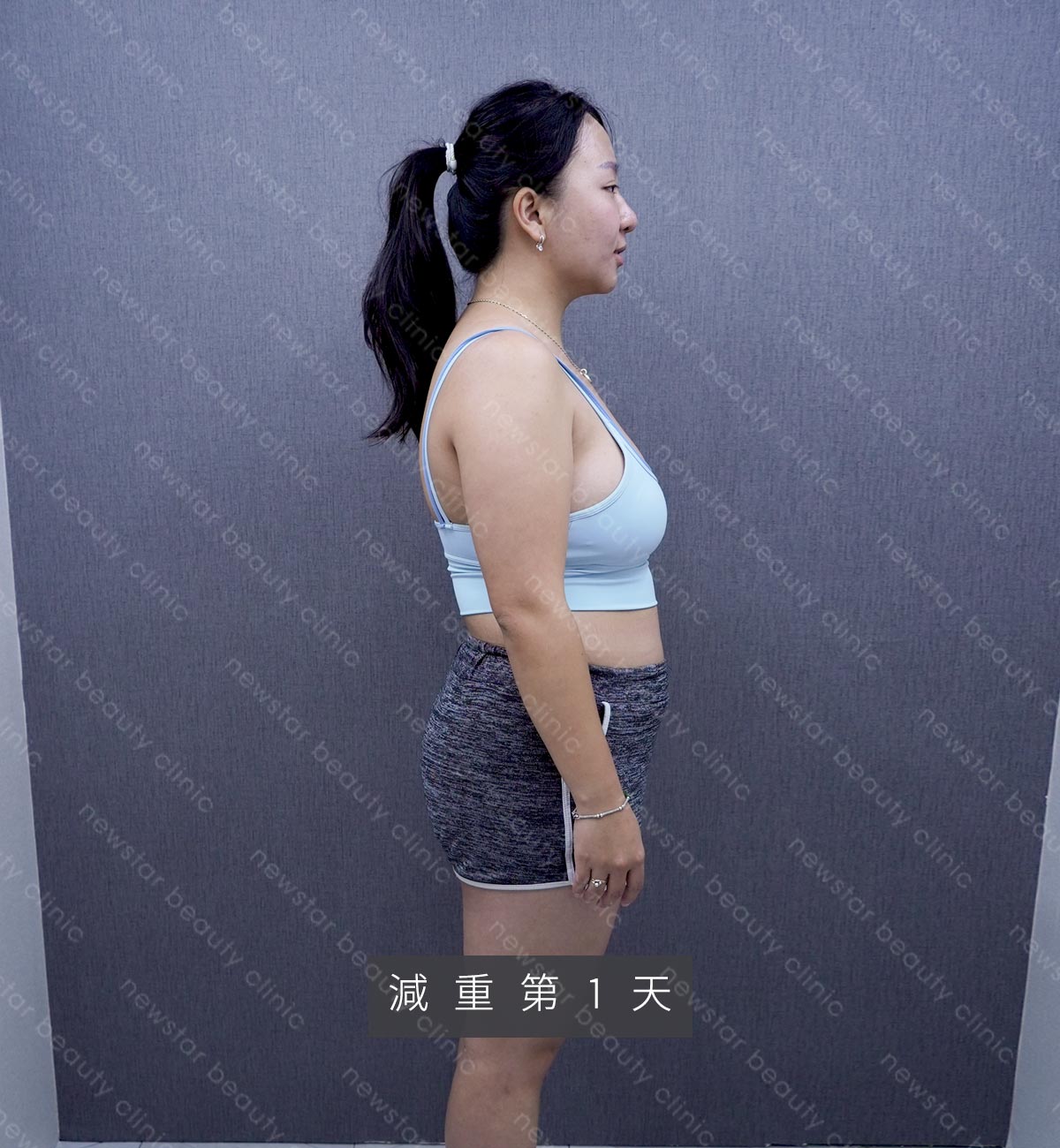 減重門診_彩意_ba_過程