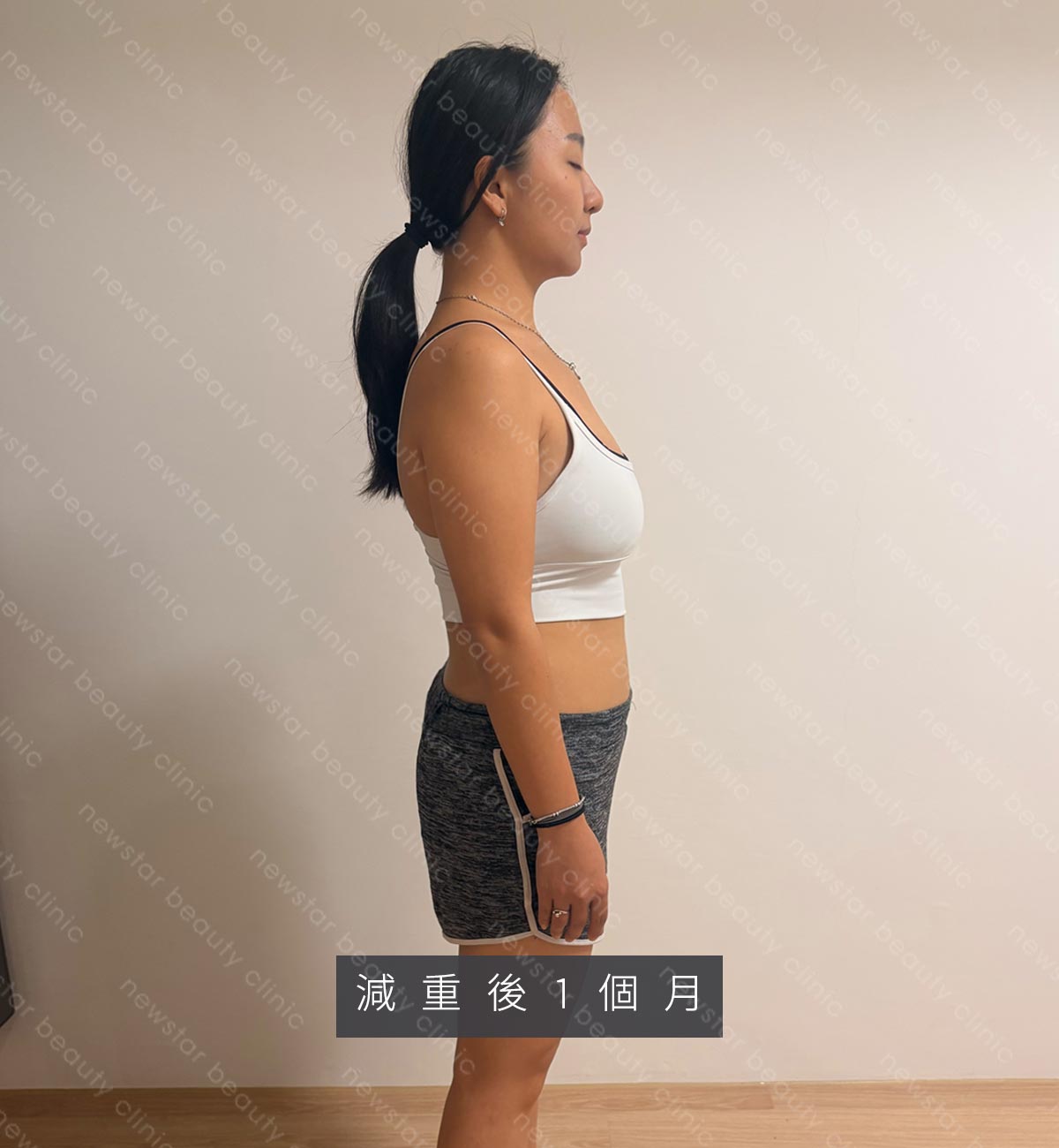 減重門診_彩意_ba_過程02