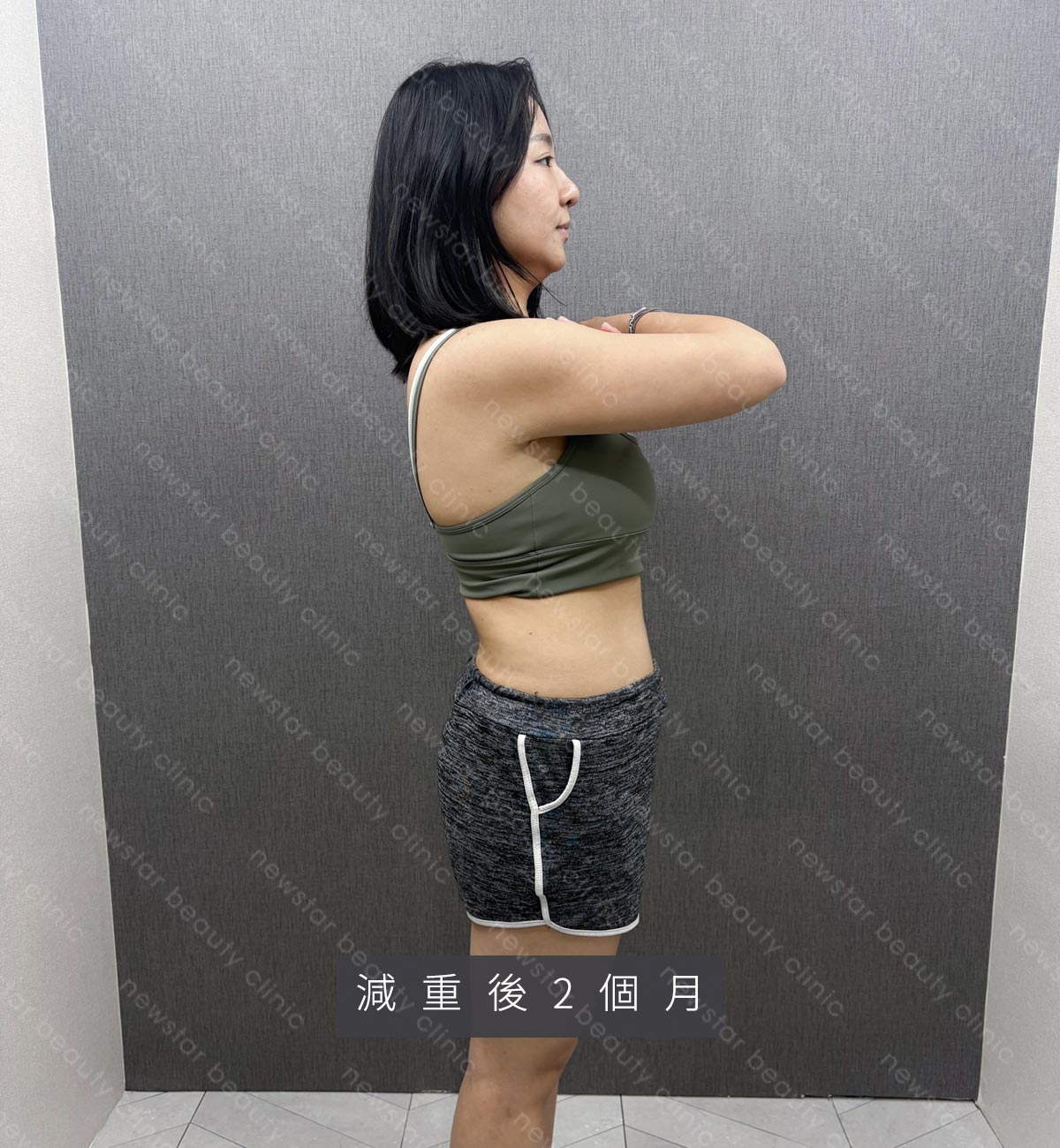 減重門診_彩意_ba_過程03