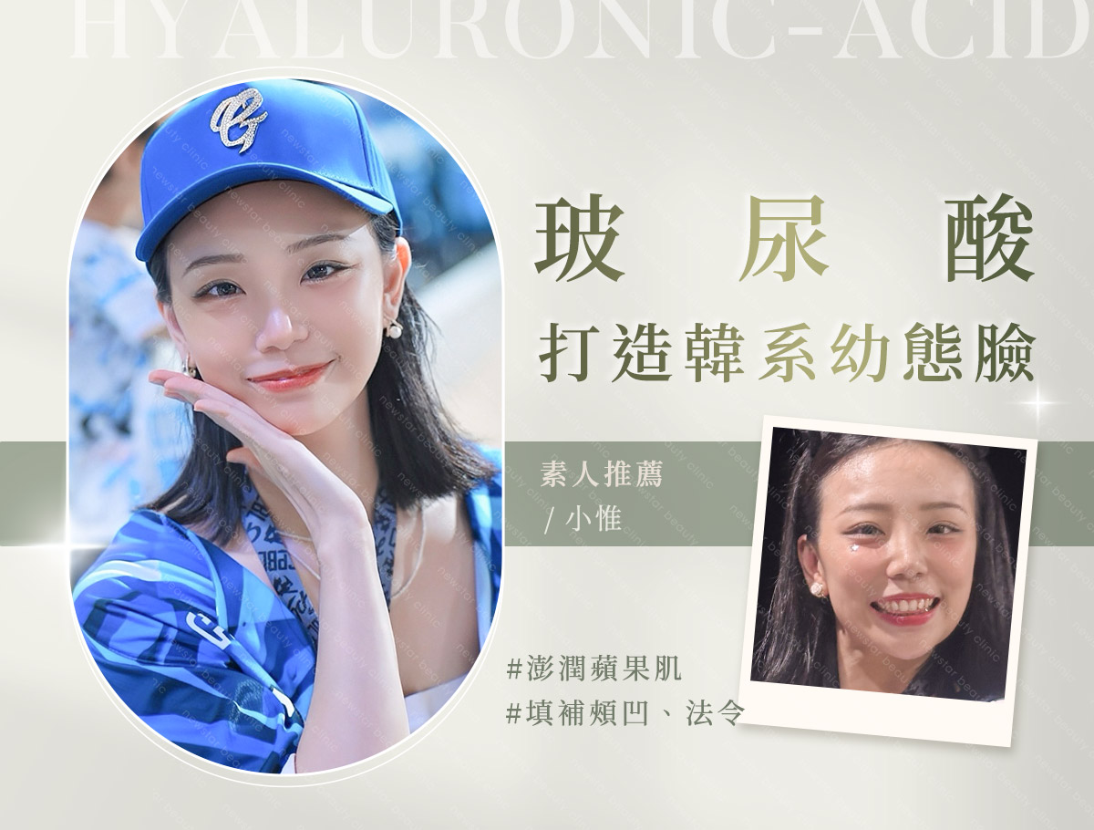 微整官網案例 外bn