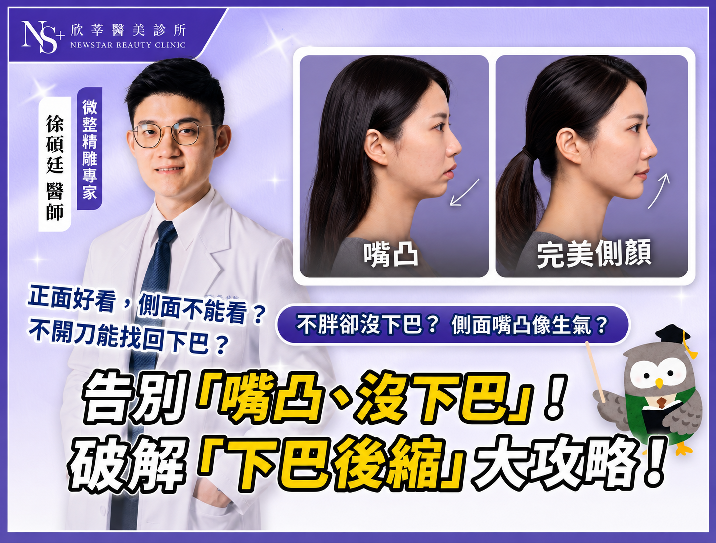 260714 徐碩廷 用微整破解下巴後縮 BN